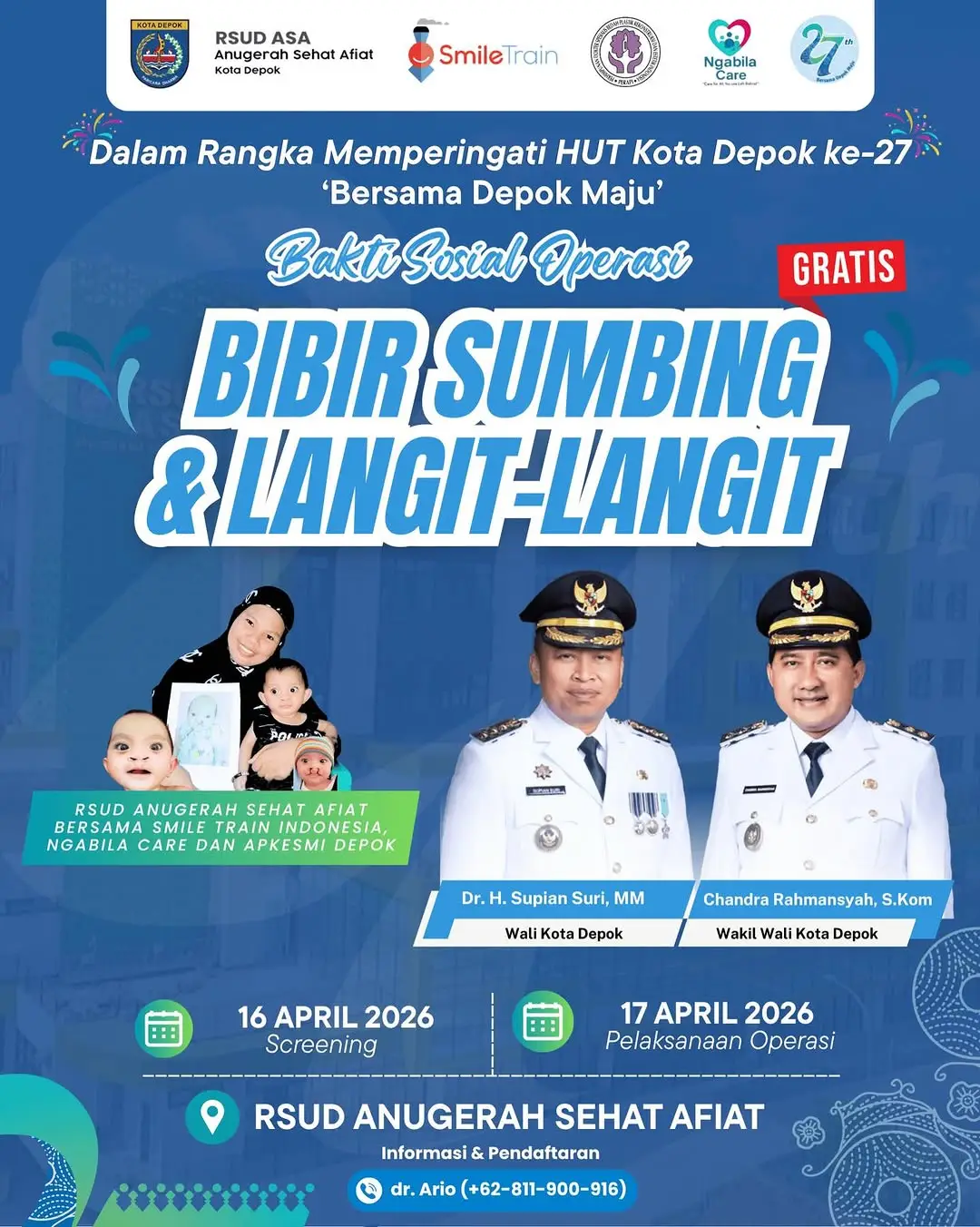Sambut HUT ke-27 Depok, RSUD ASA Buka Operasi Bibir Sumbing Gratis